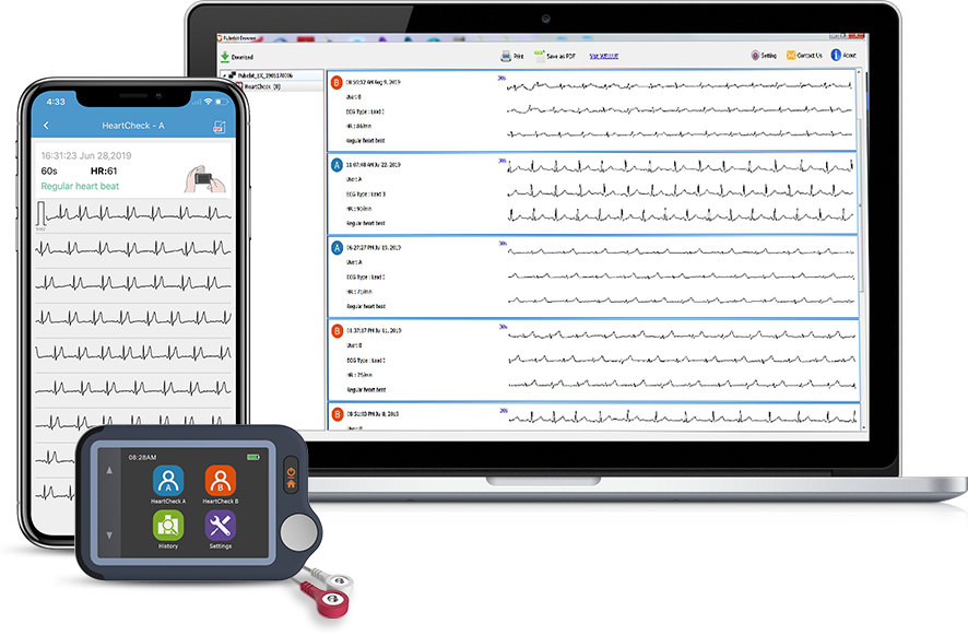 Wellue pulsebit ex ekg ecg monitor with app and PC software