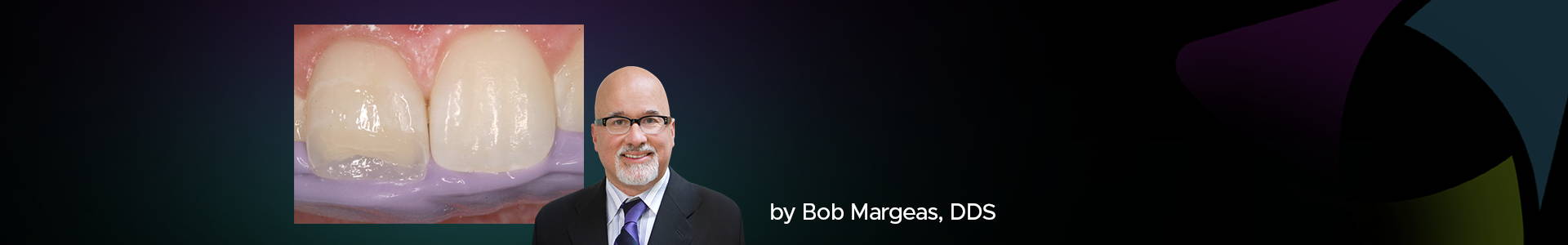 Blog banner of Dr Bob Margeas and a clinical image in the back