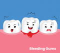 photo of 3D bleeding gums demonstration