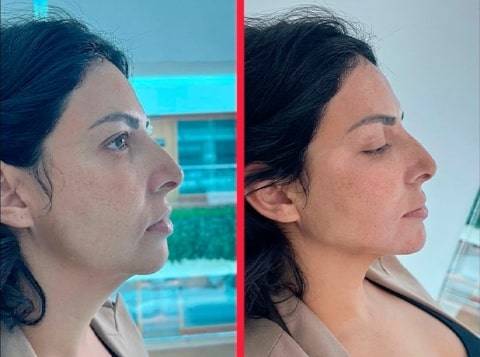 Seurico™ Contour Mask