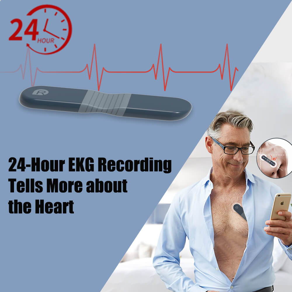 Wellue EKG-Recorder mit AI-Analyse, Holter-Monitor-Test, Holter-Monitor-Kosten, 24-Stunden-Holter-Monitor, tragbarer EKG-Monitor, tragbarer EKG-Monitor, Holter-Monitor