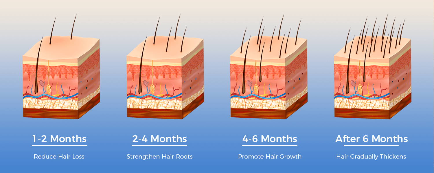 procedure of hair growth