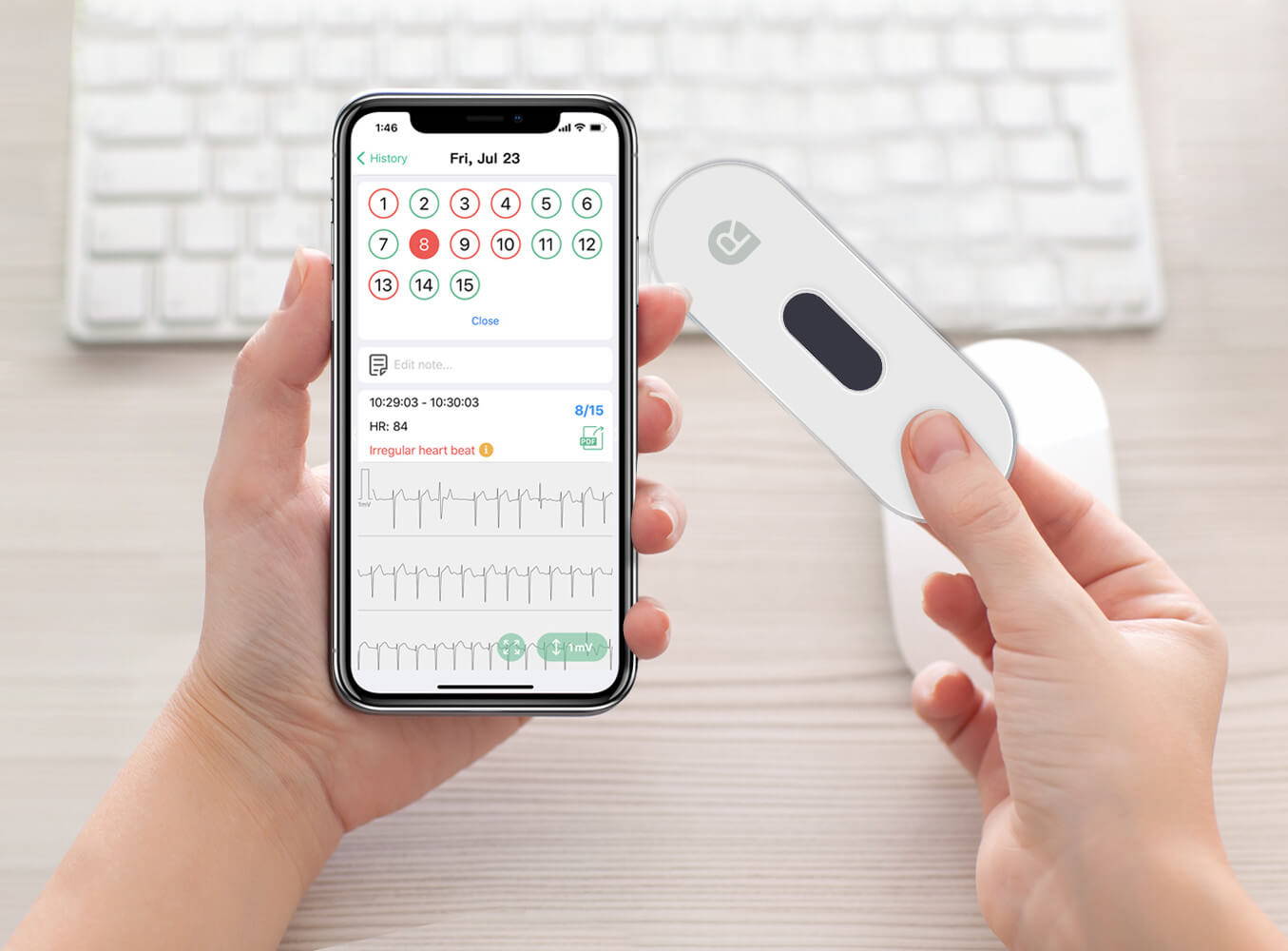 monitor de EKG portátil de mano, tomar EKG de grado médico, tomar EKG instantáneo, informe de la aplicación en el monitor de EKG