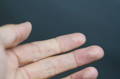 close up of hand showing fingertips