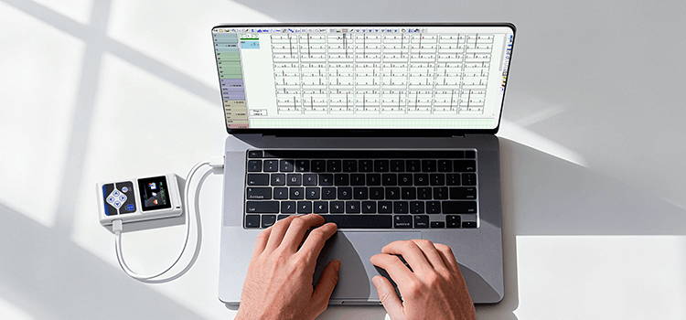 detect irregular heartbeat (arrhythmias) with Wellue 24-Hour ECG Recorder with AI analysis