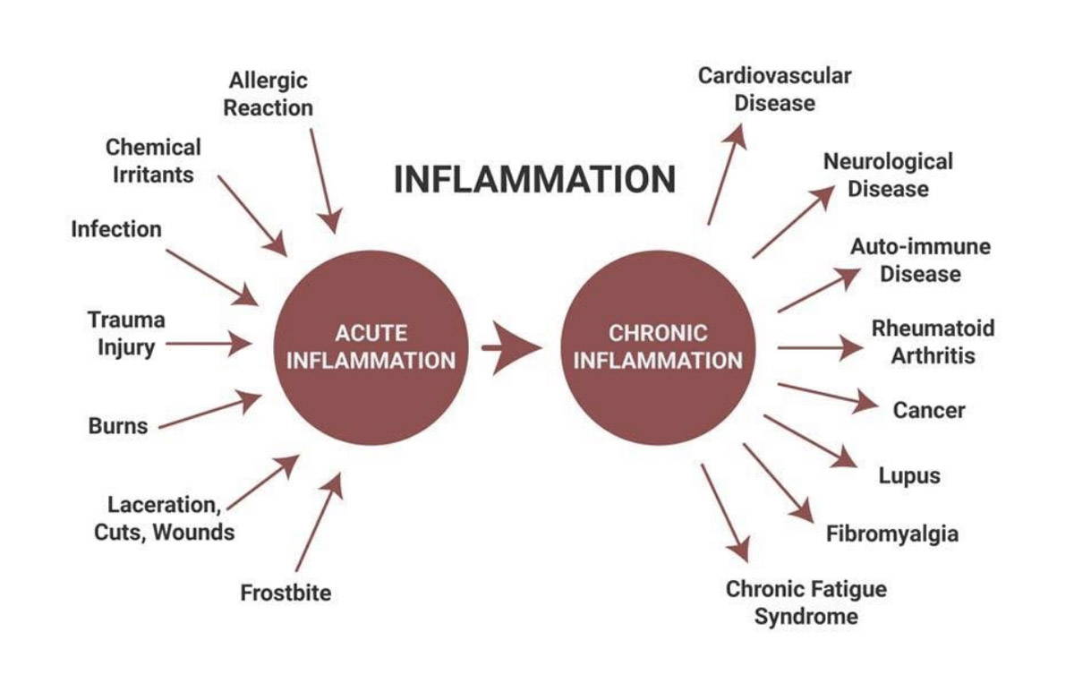 Everything You Need To Know About Inflammation And How To Reduce It