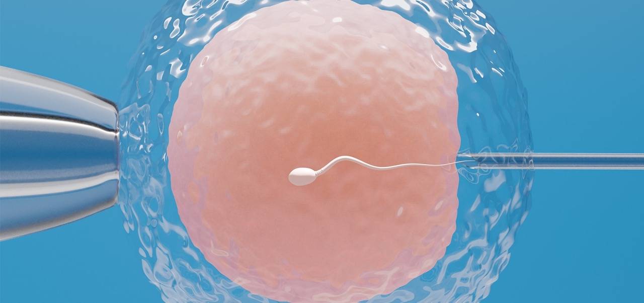 Darstellung eines Spermiums das in eine Eizelle injiziert wird