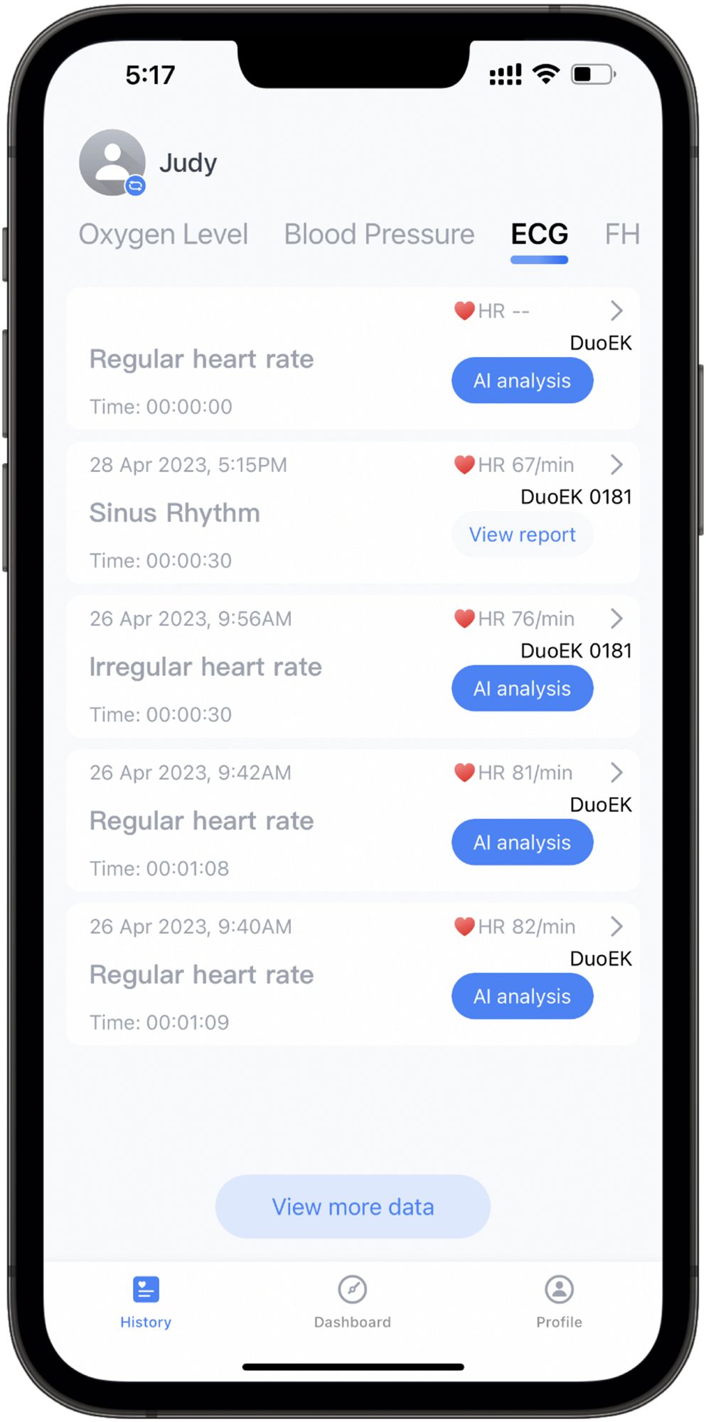 EKG-/EKG-Berichte über die App aufzeichnen und teilen