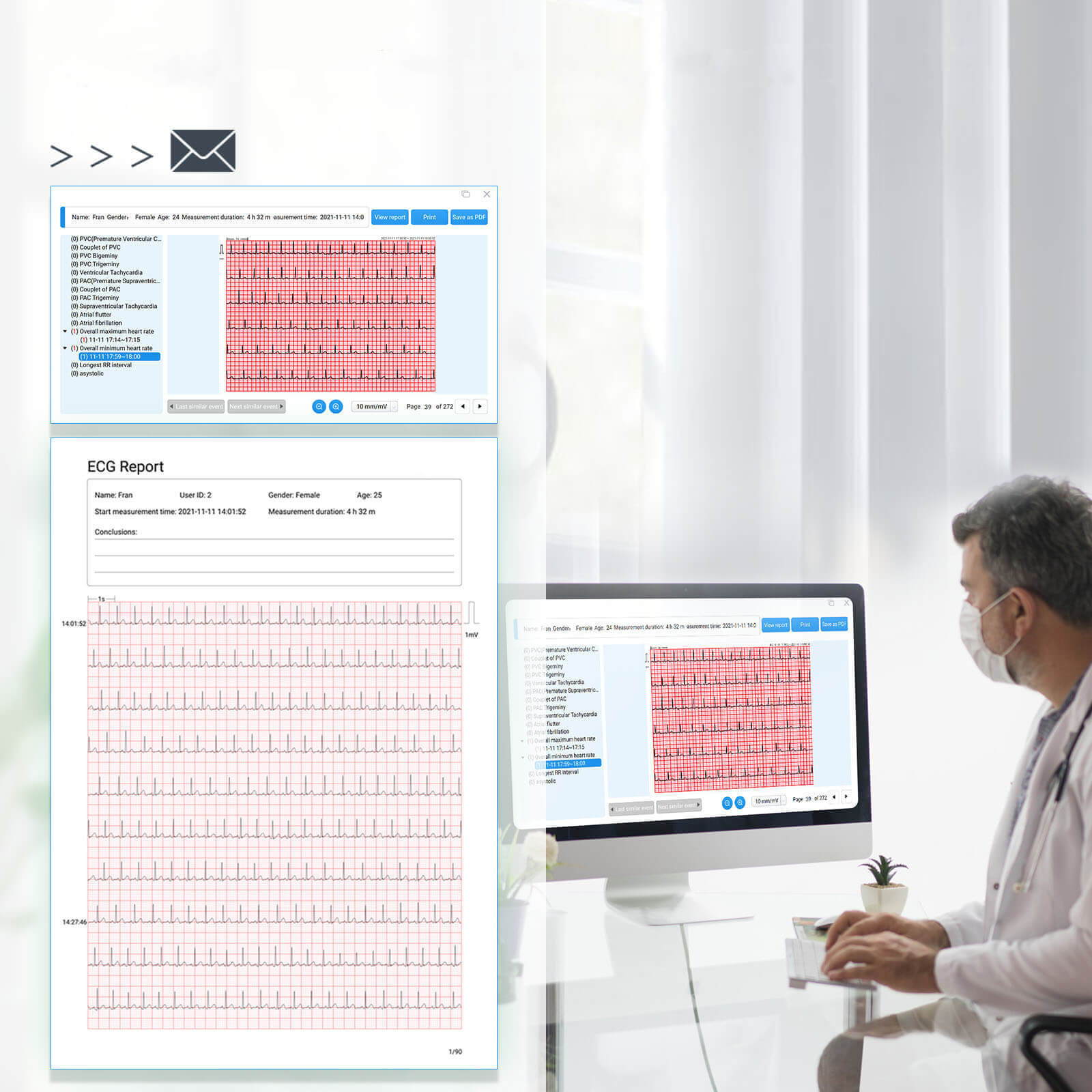 share ecg/ekg reports with your doctors