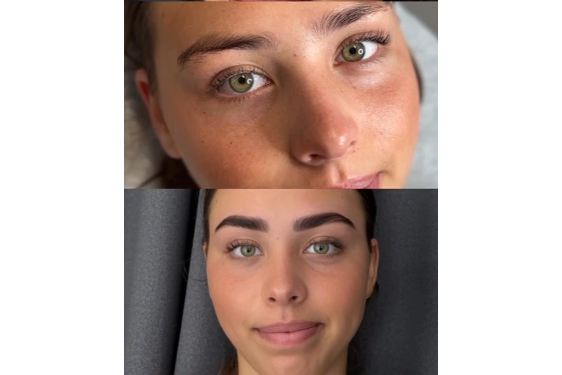 Lume’Ink Cosmetic Tattoo Voucher - Image 3