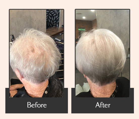 Before and After 1