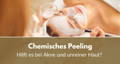 chemisches peeling akne