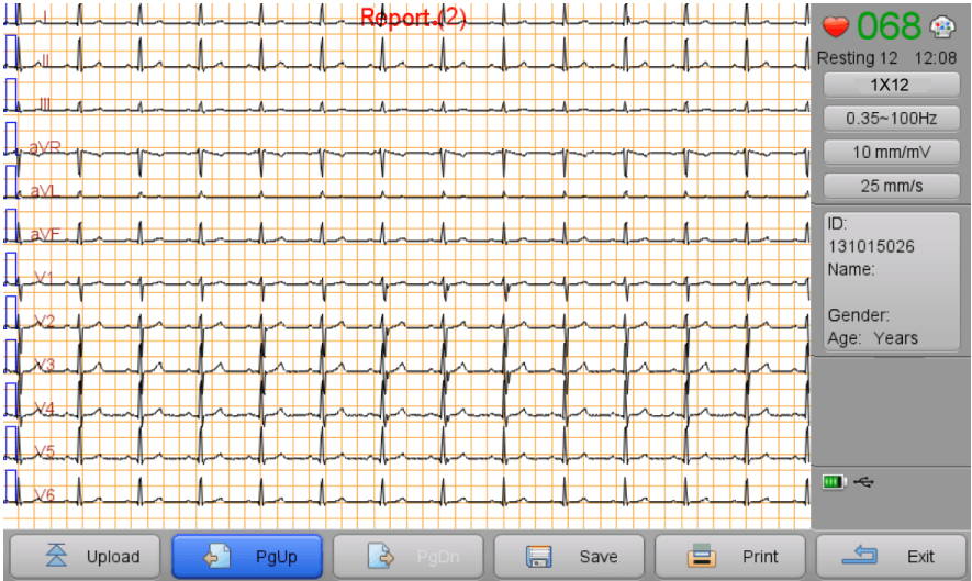 View and record realtime waveforms and heart rates in one small ekg machine.