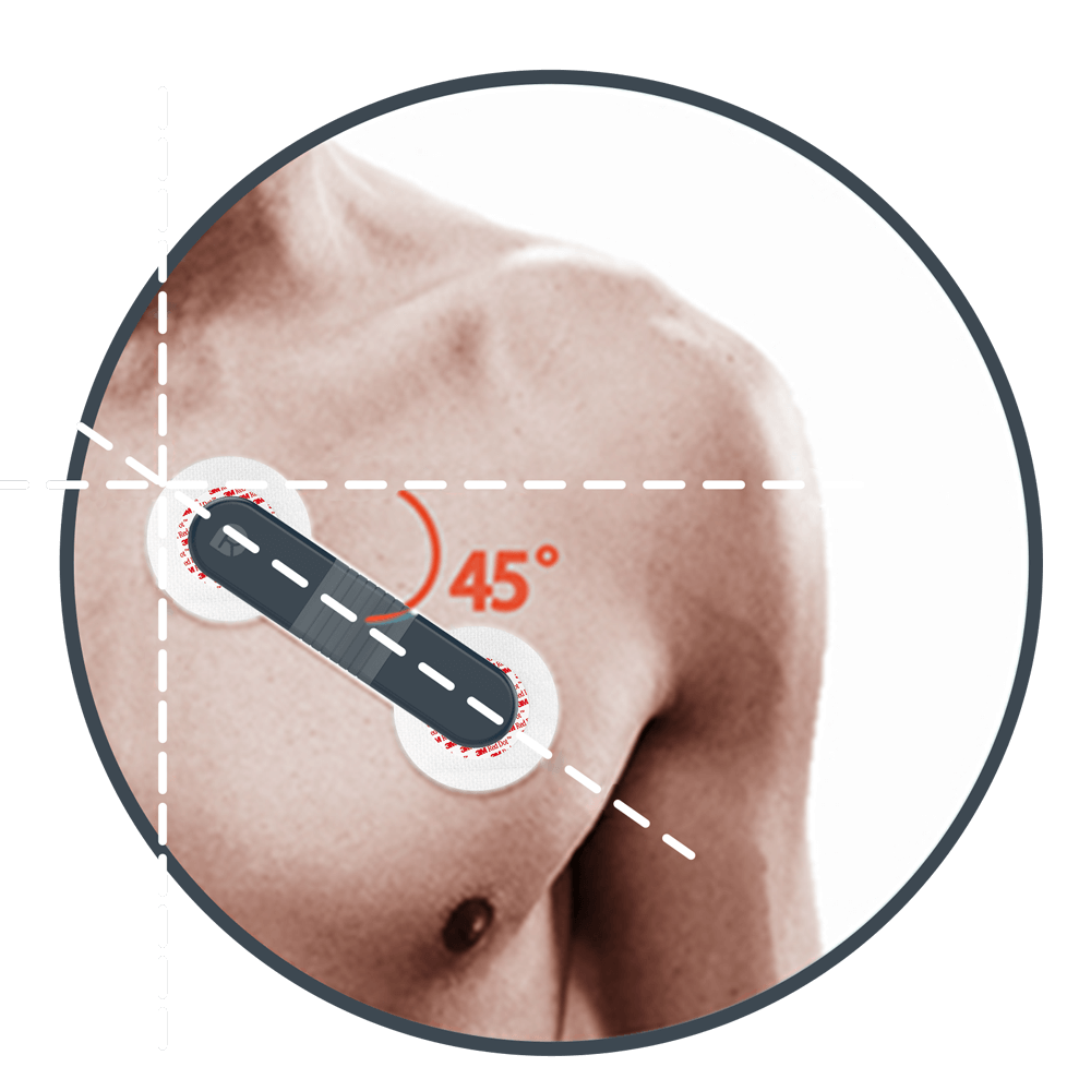 EKG-Monitor mit Elektrodenpflaster tragen, EKG-Patch, tragbarer EKG-Monitor von Emay, Alivecor Kardiamobile, Kardiamobile 6l, Alivecor Kardiamobile EKG-Monitor
