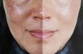 photo of woman's face - the left side showing natural skin damage over time and the right side showing how wheat grass can slow down skin damage.