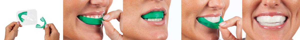 Opalescence Go Whitening Trays step-by-step instructions