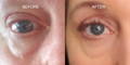 Nulastin Lash Serum Results Before After