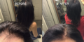 Nulastin-Scalp-Hair-Results-Before-After