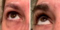 Nulastin Lash Serum Results Before After