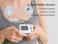 Holter, Holter-Monitor, 12-Kanal-Holter-Monitor, 12-Kanal-Holter-Monitor, EKG-Monitor, EKG-Monitor, EKG-Test, EKG-Bericht, EKG-Analyse, EKG-Holter, Künstliche Intelligenz-aktivierter EKG-Algorithmus, Künstliche Intelligenz-verstärkte Elektrokardiographie