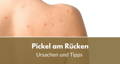 pickel am rücken ursache