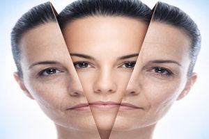 Lovely Skin and Beauty - IPL Skin Rejuvenation – Décolletage