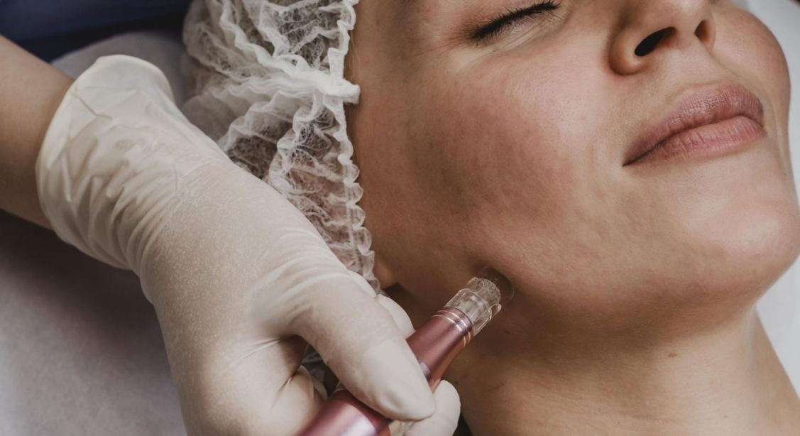 Hydra Facial Deep Cleanse