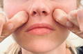 Massage gegen Nasolabialfalte