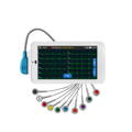 tableta de ecg de 12 derivaciones