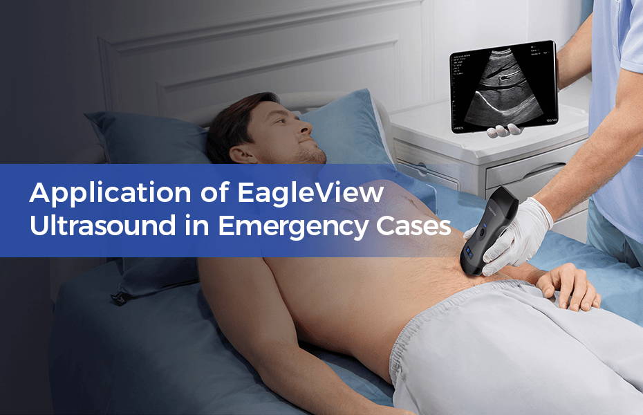 Application of EagleView Portable Ultrasound in Emergency Cases 