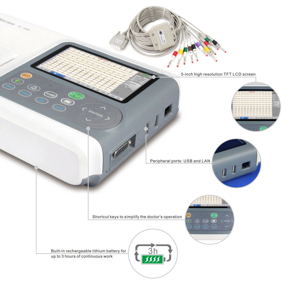 I dettagli della macchina per ECG Wellue Biocare ingrandiscono, dimensioni dello schermo, porte, tasti di scelta rapida e durata della batteria.