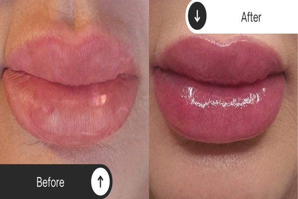 Cosmetic Tattoo by Atelier Beauty & Permanent Make-up - Image 2