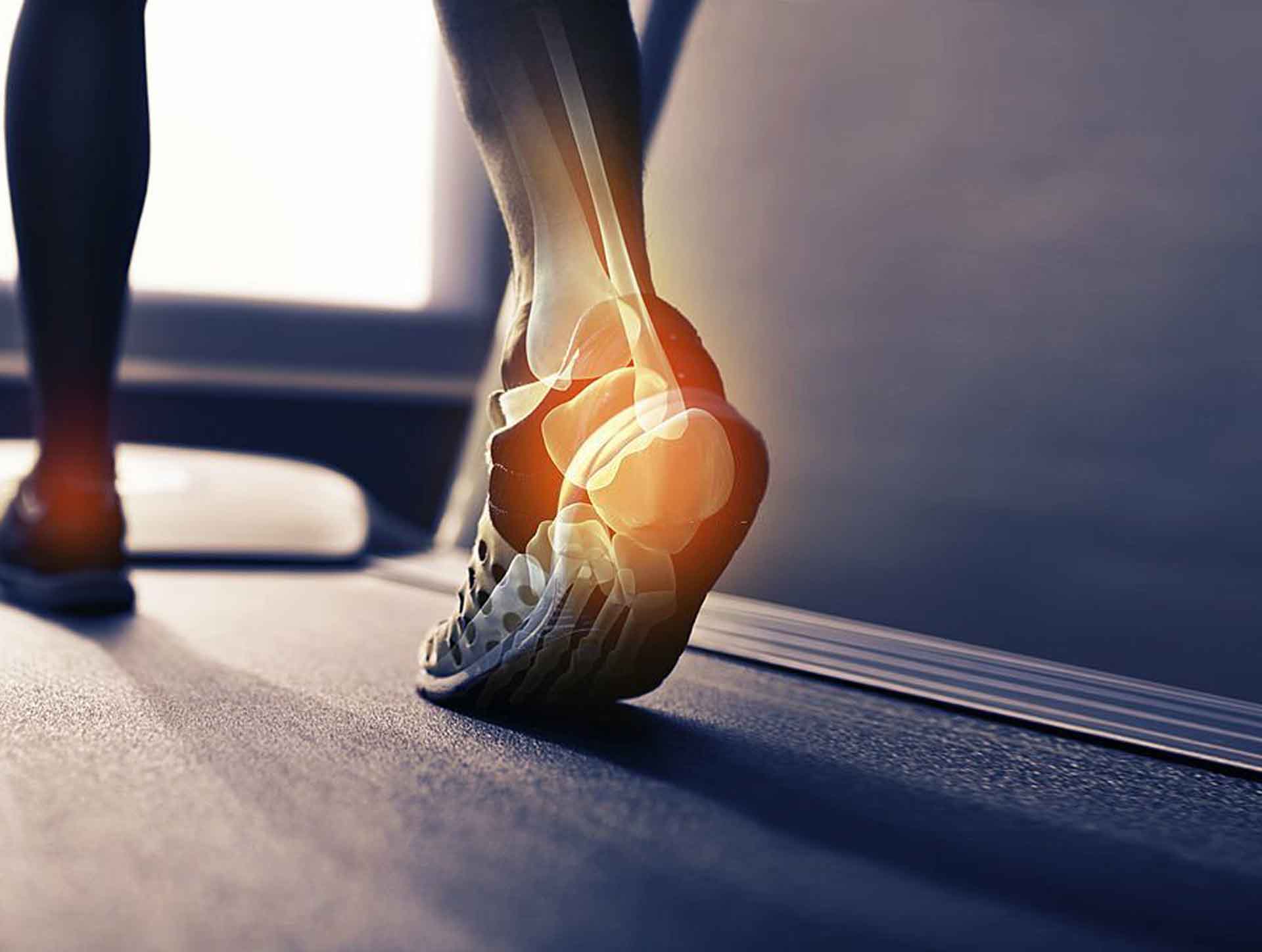 How to Combat Plantar Fasciitis FlareUps for Good? Koprez®