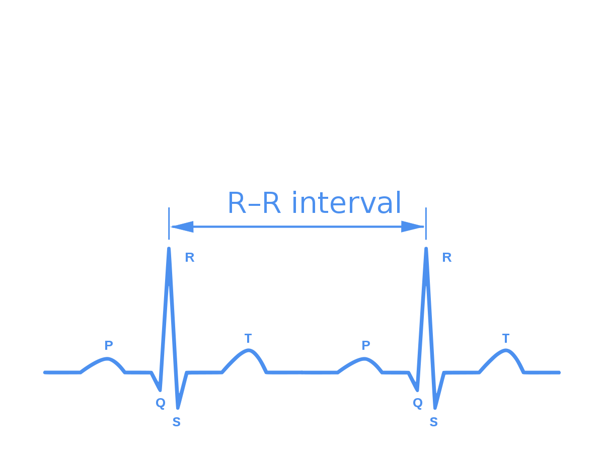 R-R ECG analysis