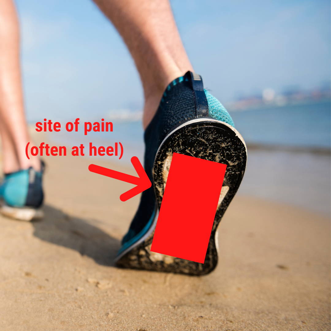 heel pain