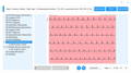 Kundenrezension Wellue EKG-Rekorder