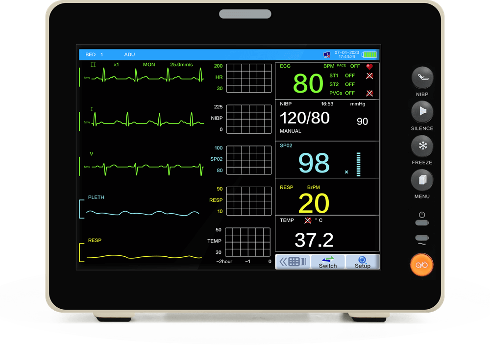 trend coexist view of 8-inch touchscreen patient monitor