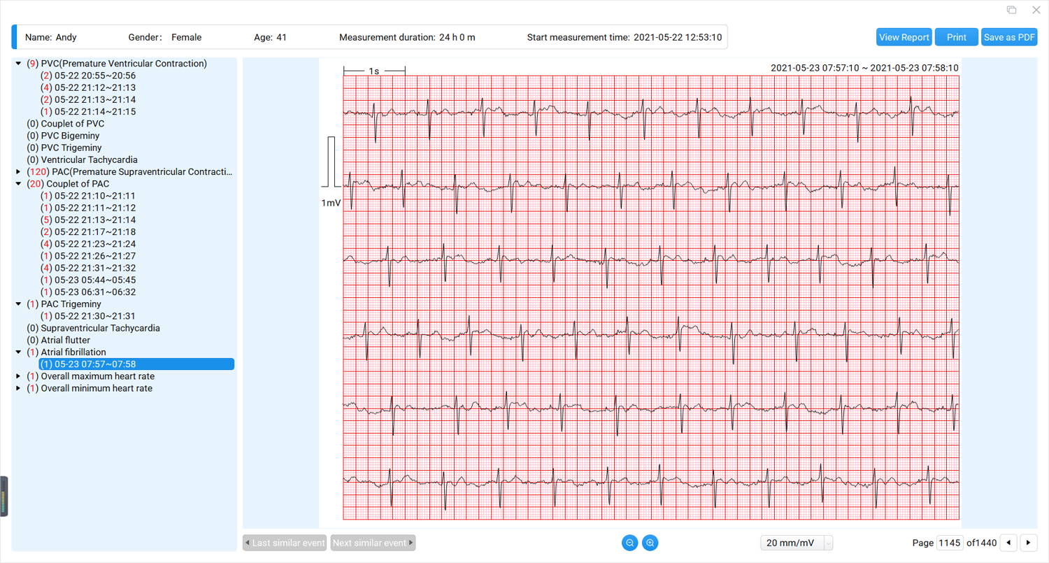 download electrocardiogram (ecg/ekg)