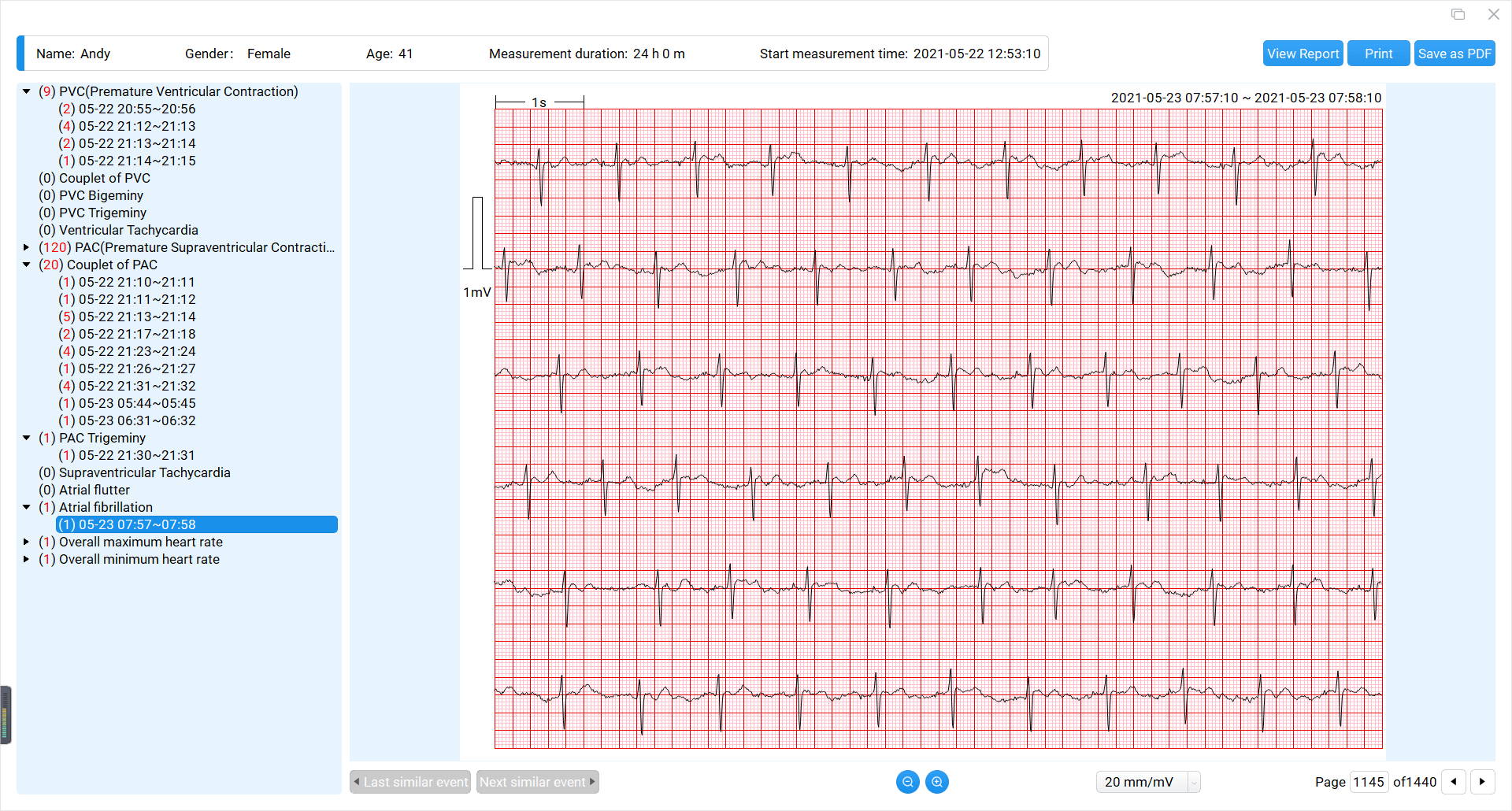 download the ECG waveforms as PDF files