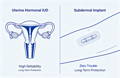 zero trouble birth control