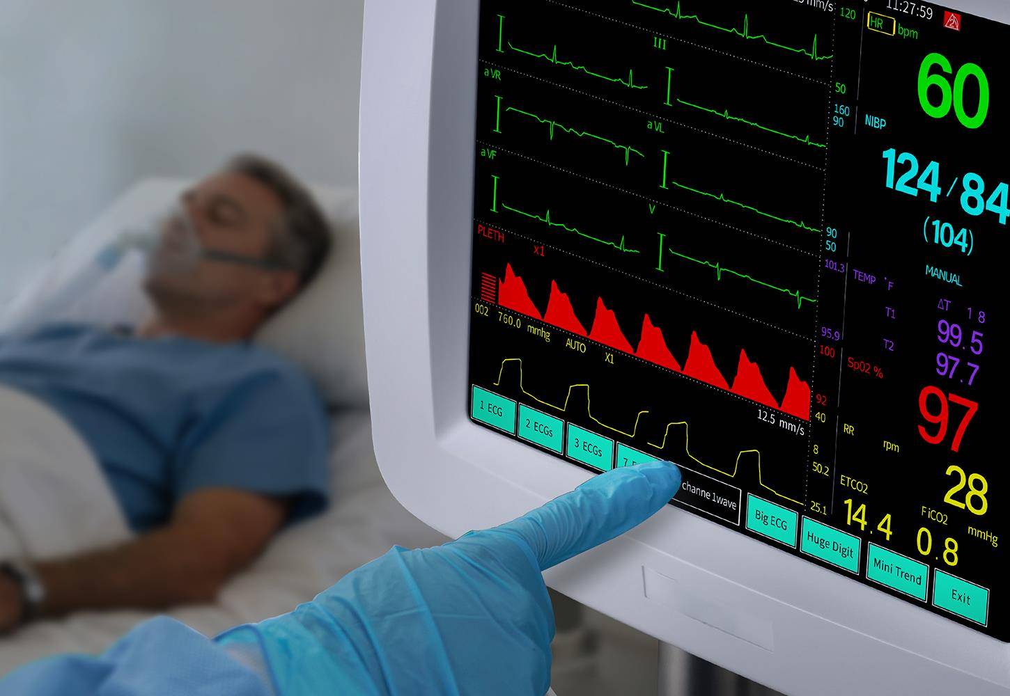 10-Inch Patient Monitor
