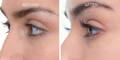 Nulastin Lash Serum Results Before After