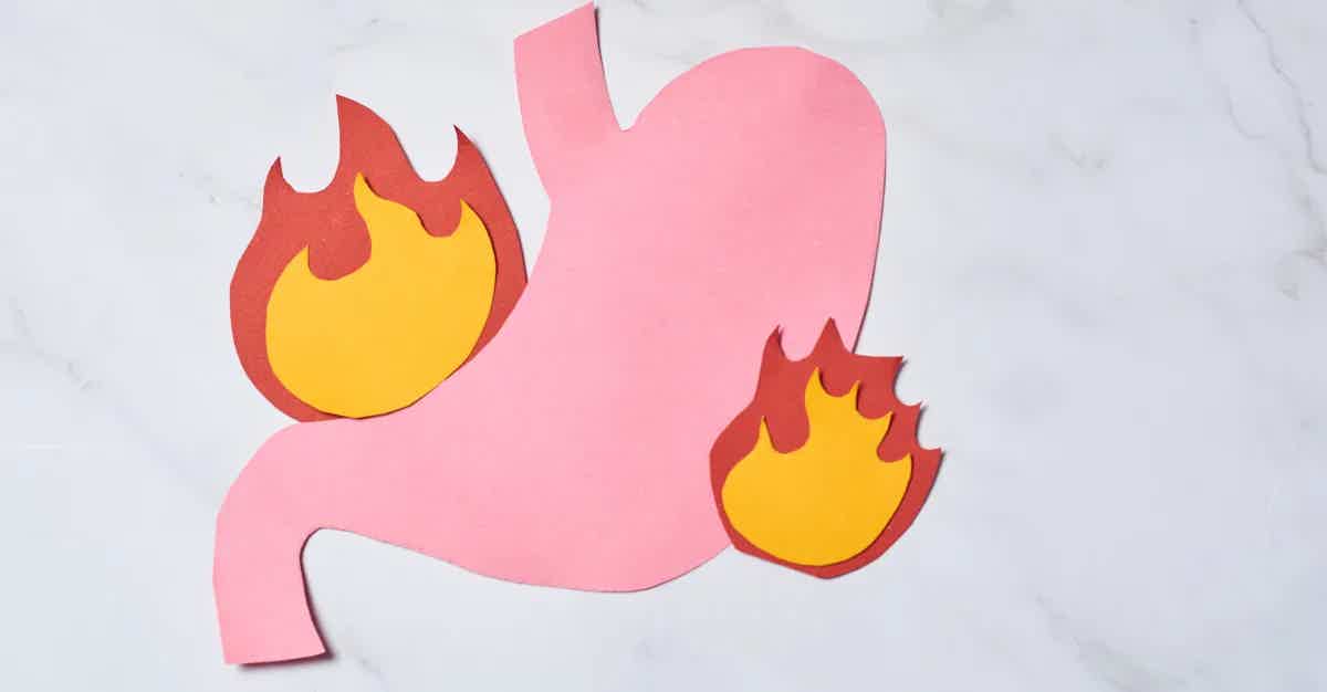 ACID REFLUX: NATURAL RELIEF AND PREVENTION