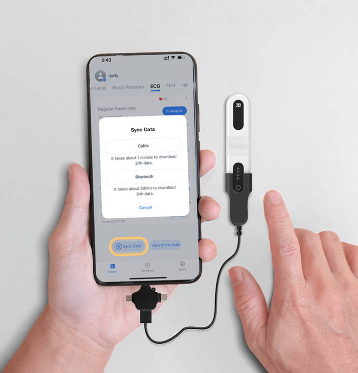 ECG Data Transfer and AI Analysis via App