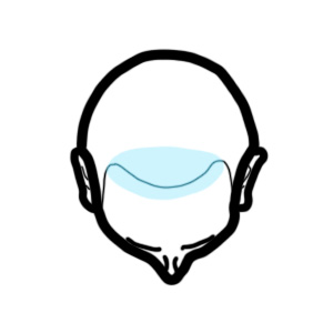 laser helmet for receding hairline, laser cap for receding hairline, laser hair growth helmet receding hairline