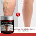 before and after Varicose Veins Relief Cream