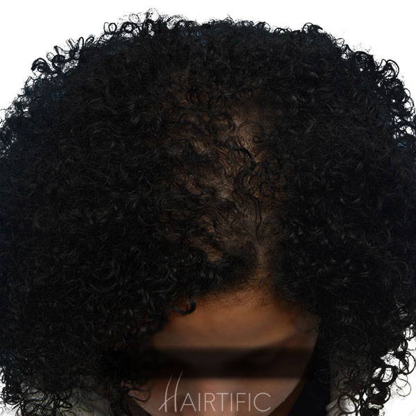 laser hair growth cap, laser cap for hair growth after, laser helmet