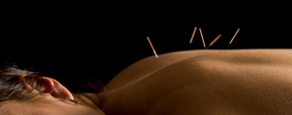 12 Enchanting Facts About Acupuncture
