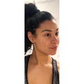 PERSONALISED MEDICAL SKINCARE BEFORE