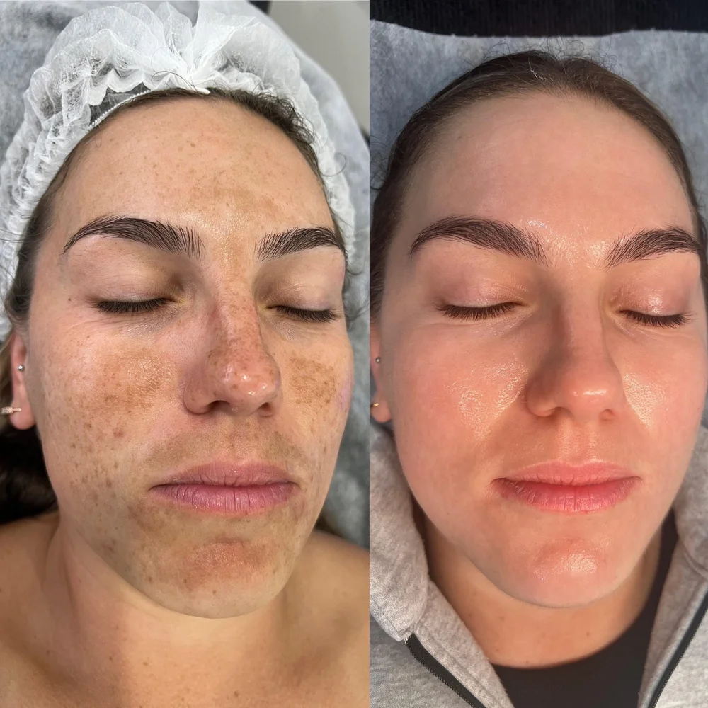 Haus of Dermal Voucher - Image 4